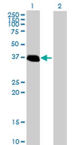 ZNF444 Polyclonal Antibody, MaxPab™