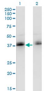ZNF444 Antibody in Western Blot (WB)