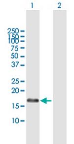 RFK Polyclonal Antibody, MaxPab™