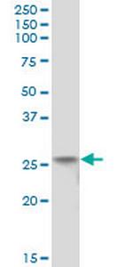 FLJ11184 Antibody in Western Blot (WB)
