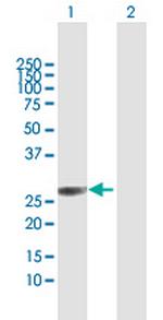 C4orf43 Antibody in Western Blot (WB)