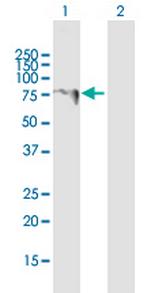 LARP6 Antibody in Western Blot (WB)
