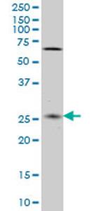 CNO Antibody in Western Blot (WB)