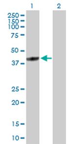 FBXL8 Polyclonal Antibody, MaxPab™