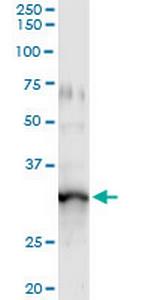GIMAP5 Monoclonal Antibody (1E10)