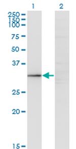 GIMAP5 Antibody in Western Blot (WB)