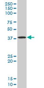 STYK1 Antibody in Western Blot (WB)