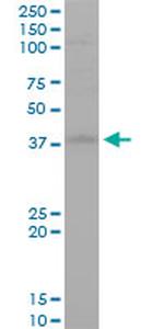 STYK1 Antibody in Western Blot (WB)