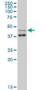 STYK1 Antibody in Western Blot (WB)
