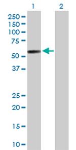 PI4K2A Antibody in Western Blot (WB)