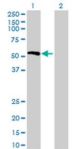 PPP4R1L Antibody in Western Blot (WB)