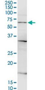CSGALNACT2 Polyclonal Antibody, MaxPab™