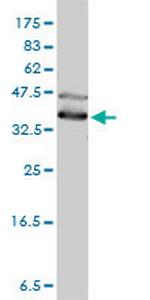 DNAJA4 Monoclonal Antibody (4B4-1F2)