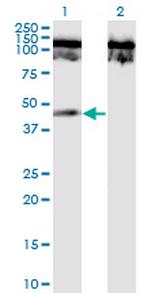 TNFRSF19 Monoclonal Antibody (1H6)