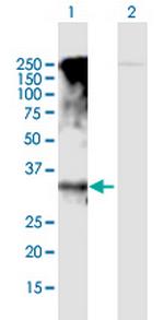 GPRC5D Polyclonal Antibody, MaxPab™