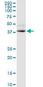 GPRC5D Monoclonal Antibody (6D9)