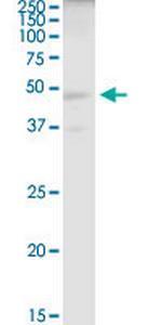 ELAC1 Polyclonal Antibody, MaxPab™