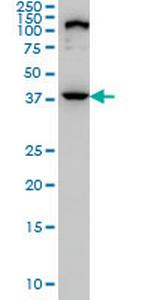 ELAC1 Monoclonal Antibody (1G2)