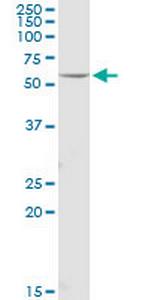 FOXRED1 Antibody in Western Blot (WB)
