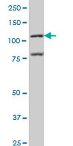BMP2K Antibody in Western Blot (WB)