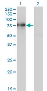 BMP2K Monoclonal Antibody (1F11)