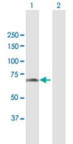 CDKN2AIP Polyclonal Antibody, MaxPab™