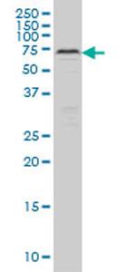 CARF Antibody in Western Blot (WB)