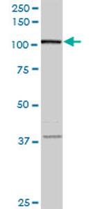 FLJ20097 Antibody in Western Blot (WB)
