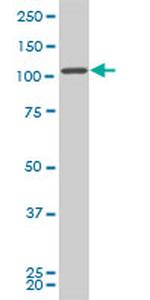 FLJ20097 Antibody in Western Blot (WB)