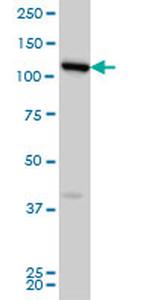 FLJ20097 Antibody in Western Blot (WB)