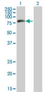 MTMR8 Polyclonal Antibody, MaxPab™