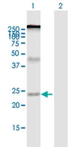 ZDHHC7 Polyclonal Antibody, MaxPab™