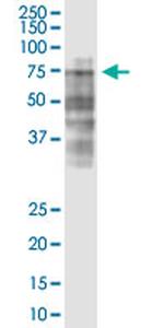 LRRC40 Monoclonal Antibody (3E10)