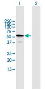 TBC1D22B Polyclonal Antibody, MaxPab™