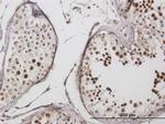 LYAR Antibody in Immunohistochemistry (Paraffin) (IHC (P))