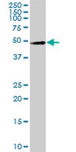 LYAR Antibody in Western Blot (WB)