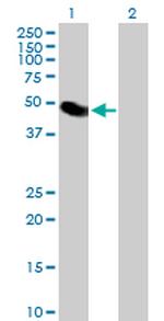 LYAR Antibody in Western Blot (WB)