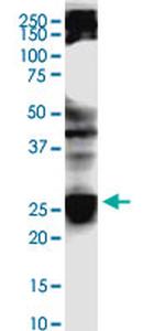 BCAS4 Monoclonal Antibody (4D4)