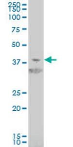 HIF1AN Monoclonal Antibody (1D8)