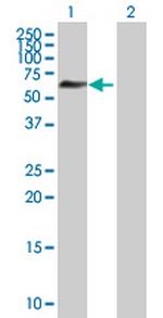 ZNF446 Polyclonal Antibody, MaxPab™