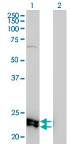 DSU Monoclonal Antibody (8F9-1B2)