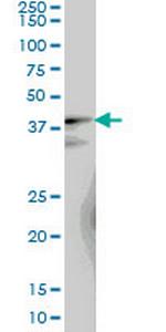 LUC7L Monoclonal Antibody (2D10)