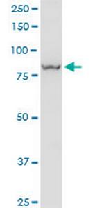 VPS35 Monoclonal Antibody (2D3)