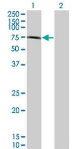 CHFR Antibody in Western Blot (WB)