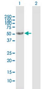 CNDP2 Polyclonal Antibody, MaxPab™