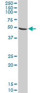 CNDP2 Antibody in Western Blot (WB)