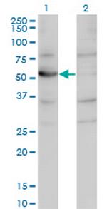 CNDP2 Monoclonal Antibody (1B1)