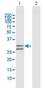 UGCGL2 Polyclonal Antibody, MaxPab™