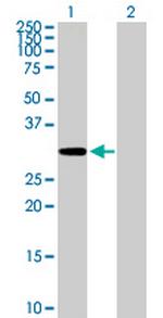 MCTP2 Polyclonal Antibody, MaxPab™