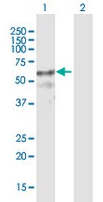 ZNF415 Antibody in Western Blot (WB)